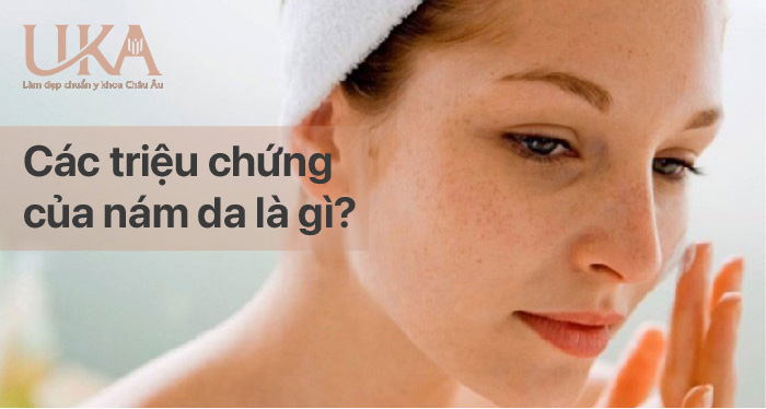 Các triệu chứng của nám da là gì?