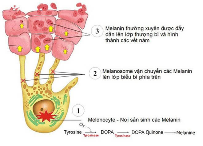 Hắc sắc tố Melanin gây nám sạm trên da