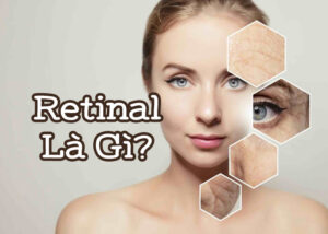 Retinal là gì